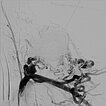 DSA – Arteriovenöse Malformation an Hals/Thorax