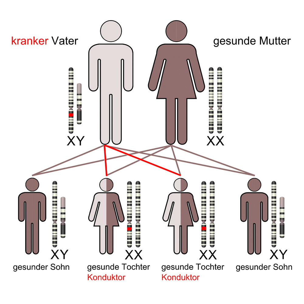 X-chromosomale Vererbung