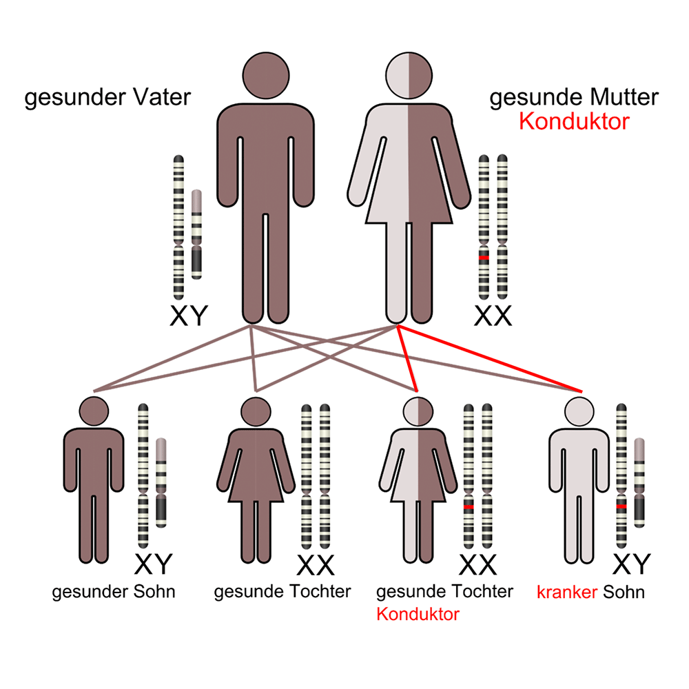 X-chromosomale Vererbung