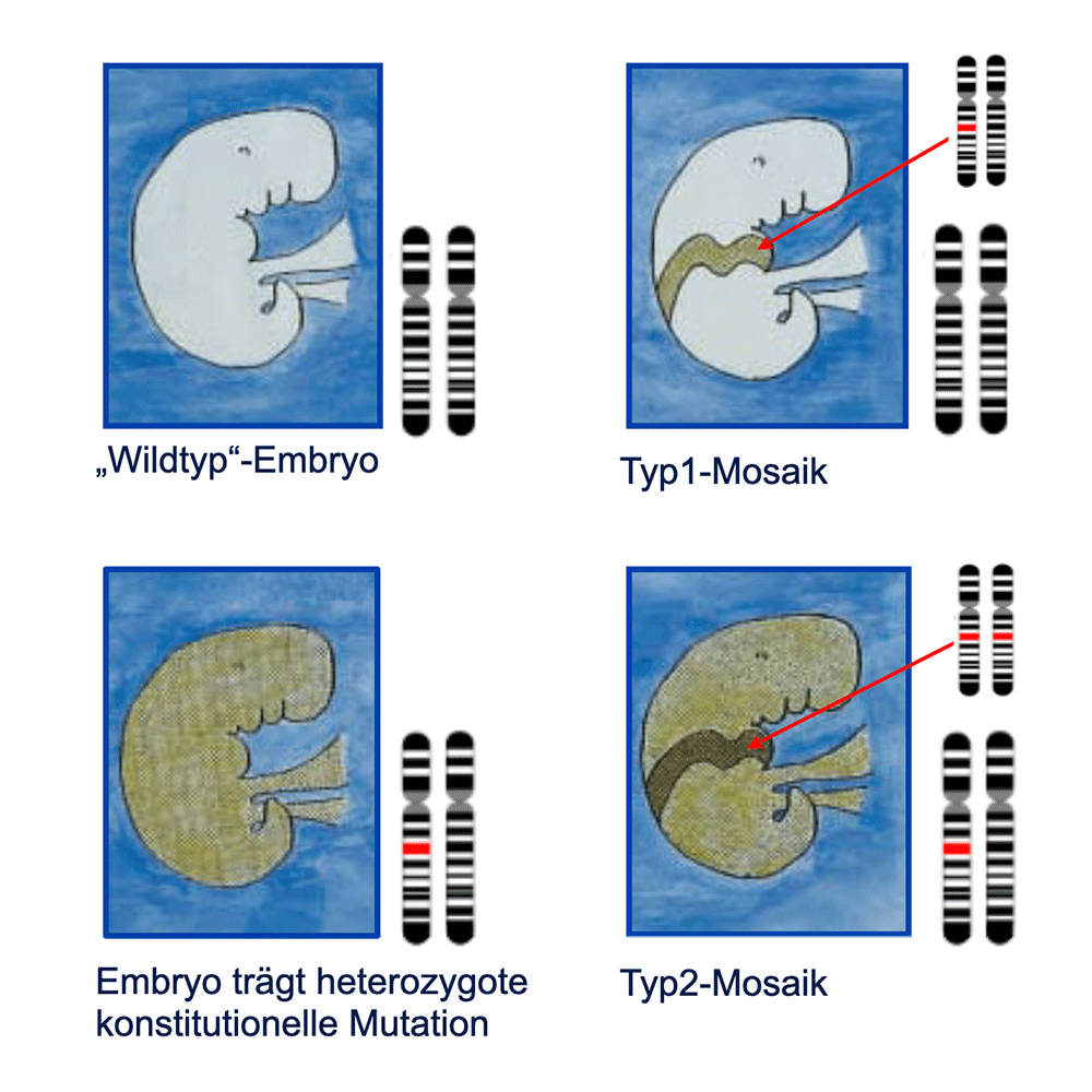 Typ1-Mosaik/Typ2-Mosaik