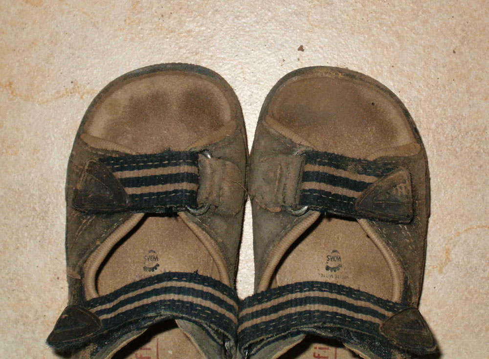 Fusslängendifferenz – Abdruck der Zehen in Schuh